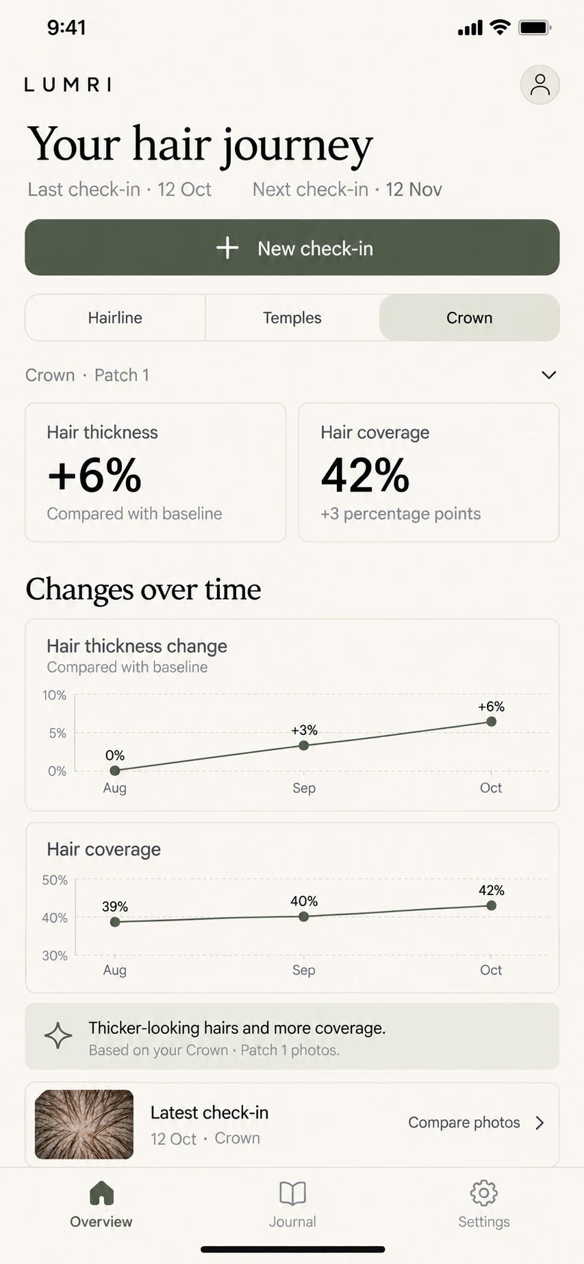 LUMRI app overview: hair thickness and hair coverage graphs over time