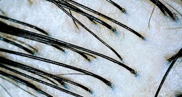 Hair roots