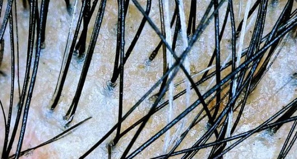 Grey hairs